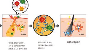 ダチョウ抗体成分によるニキビケア効果の説明図
