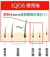 オウゴンエキスによる発毛サイクル正常化の効果の説明図